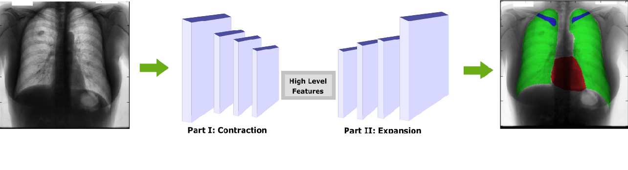 Source Fully Convolutional Architectures for Multi-Class Segmentation in Chest Radiographs